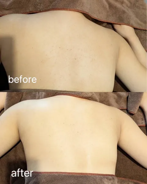 Before and After 1